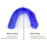 SISU Sports Mouth Guard 3D 2.0mm | Easy-to-Fit, Custom Fit Mouth Guard | MaxStrata®