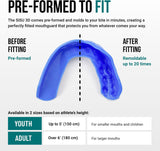 SISU Sports Mouth Guard 3D 2.0mm for Adults | Custom Fit Mouth Guard
