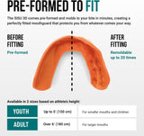 SISU Sports Mouth Guard 3D 2.0mm for Adults | Custom Fit Mouth Guard