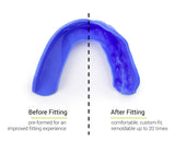 SISU Adult 2.0mm Thin Tether Mouthguard