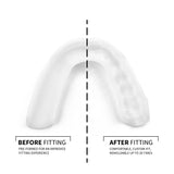 SOVA 3D Mouth Guard 1.6mm | Custom-Fit Sleep Night Guard for Clenching and Grinding Teeth | MaxStrata®